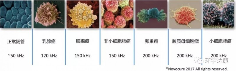 不同的癌症使用的电场频率不同